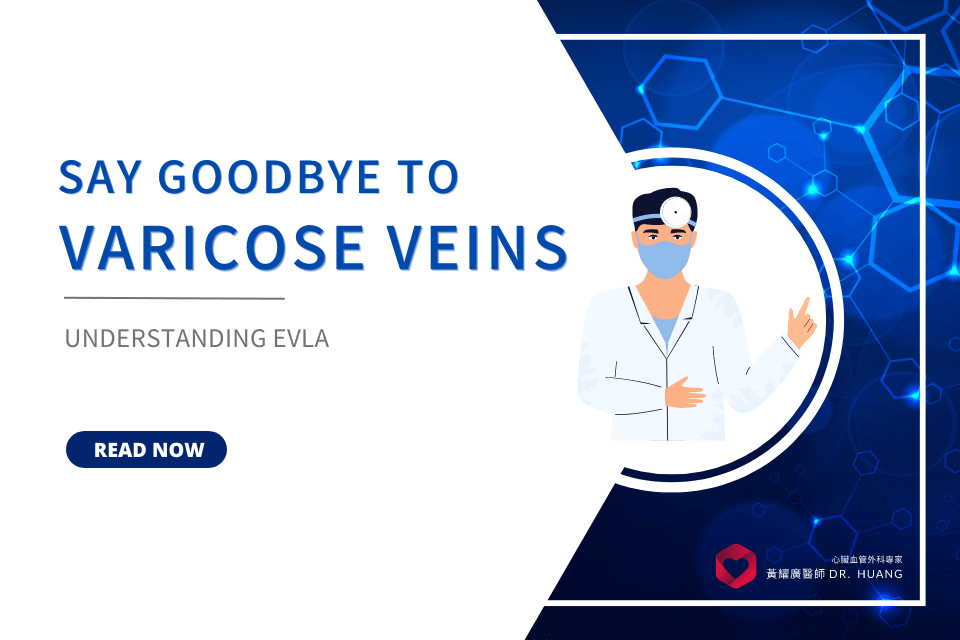 Say Goodbye to Varicose Veins: Understanding EVLA